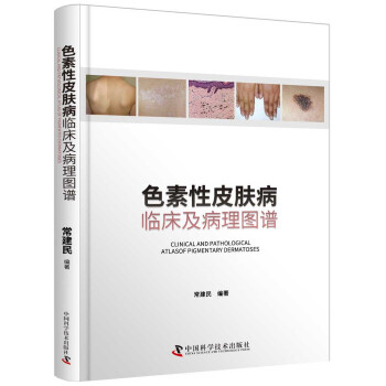 ɫ����Ƥ�w�����R��������D�V