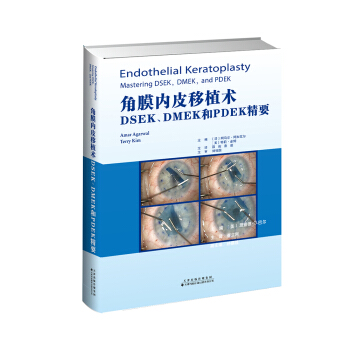 Ĥ(ni)ƤֲgMSEKDMEKPDEKҪ