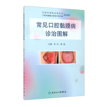 ��Ҋ(ji��n)��ǻ�Ĥ���\�ΈD��