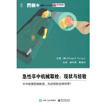  急性卒中機(jī)械取栓：現(xiàn)狀與經(jīng)驗