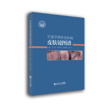  �׼����ܳ�Ҋ(ji��n)����Ƥ�w�R�D�V