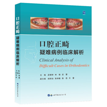 ��ǻ�������y�����R������