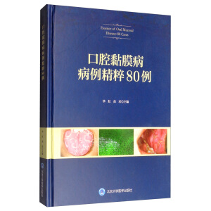 ��ǻ�Ĥ���y��������80����2016���t(y��)����