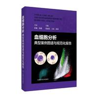 Ѫ�����������Ͱ����D�V�cҎ(gu��)�������