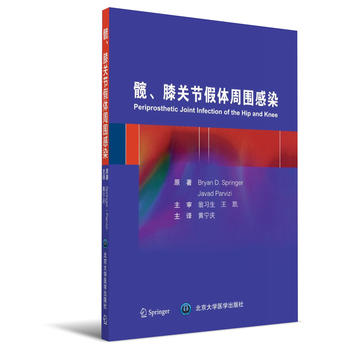 yϥP(gun)(ji)w܇Ⱦ