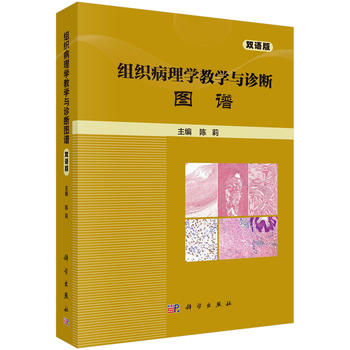 MW(xu)̌W(xu)c\DV(pZ(y))