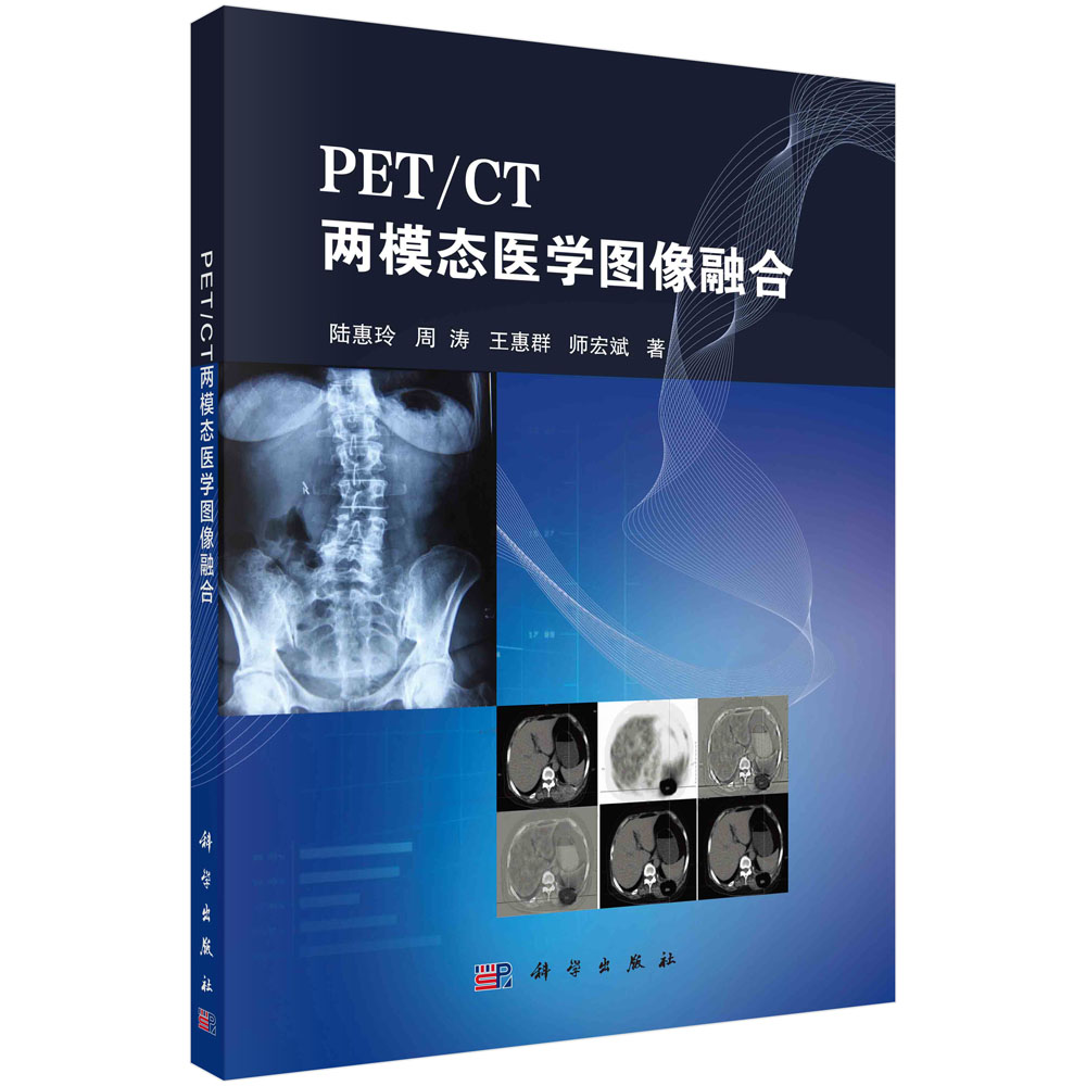 PET/CT兩模態(tài)醫(yī)學(xué)圖像融合